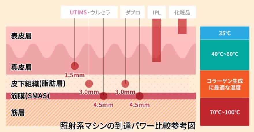 照射系麻疹の到達パワー比較