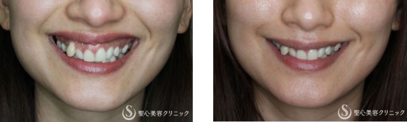 聖心美容クリニック症例写真