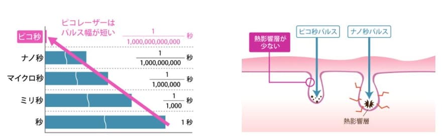 ピコレーザーの仕組み