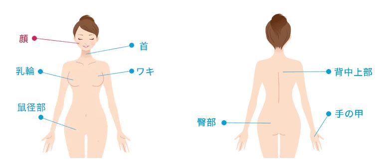 湘南美容クリニック ピコトーニング照射部位