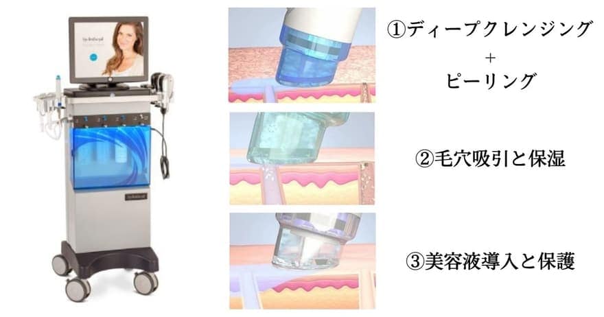 ハイドラフェイシャルの仕組み