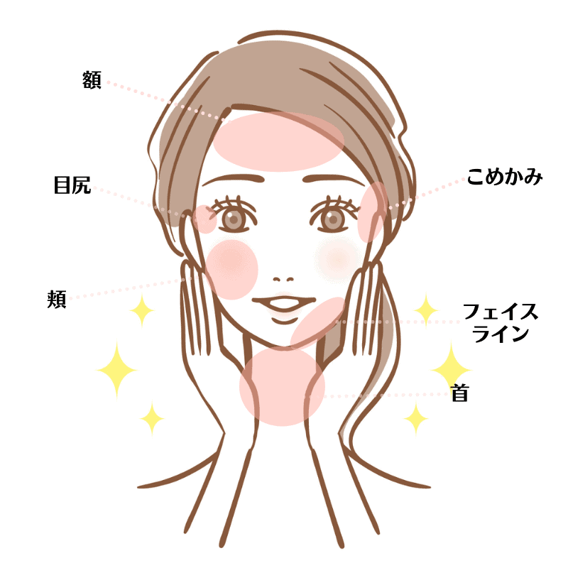 ボトックスリフト部位