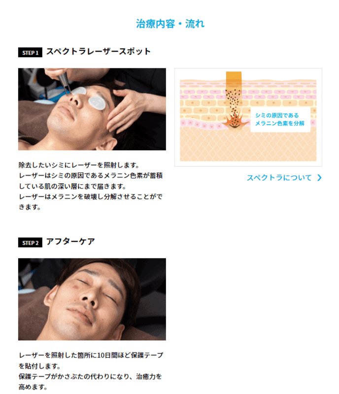 ゴリラクリニック スポットレーザー
