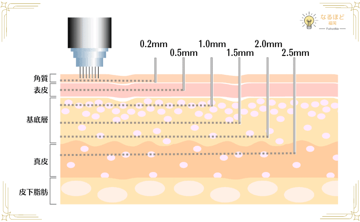 ダーマペン４のハリの種類と深さを解説したイメージ画像