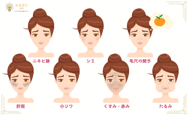 肌悩みとトラブルの各イメージ画像と説明図