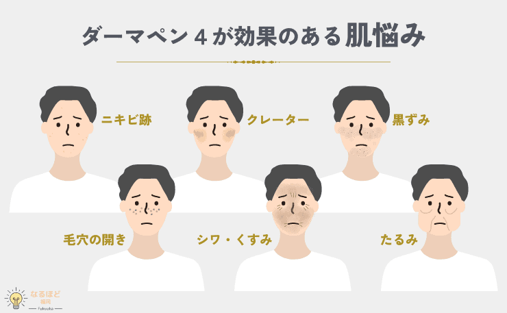 ダーマペン4の効果が出る肌悩みの例を挙げたイメージ画像