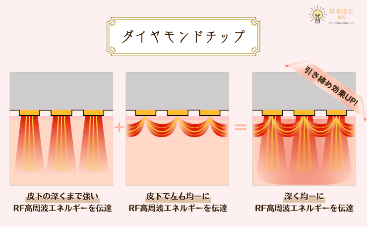 ポテンツァのダイヤモンドチップの特徴と仕組みの解説画像