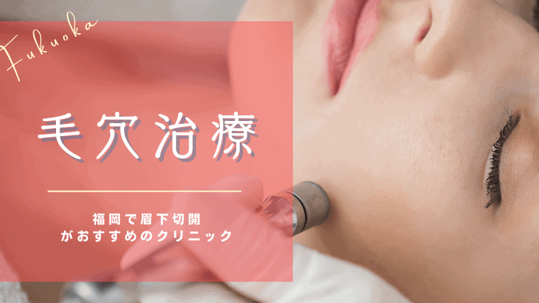 福岡で毛穴治療がおすすめのクリニック10選！安く気軽に美容皮膚科で治療できる施術