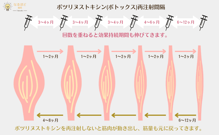 エラボトックスの施術間隔と効果の持続期間を現したイメージ図