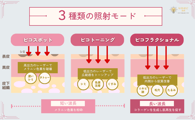 ピコレーザーの3種類の出力程度とその比較画像