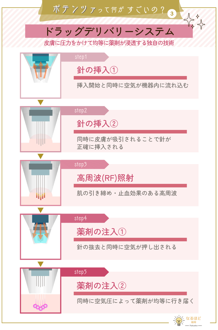 ポテンツァのドラッグデリバリーシステムの機器の行程と仕組みを解説した画像