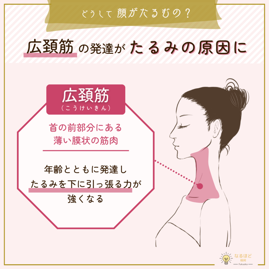 広頚筋が発達することによってたるみの原因となる理由を解説したイメージ画像