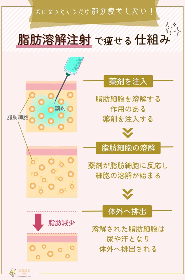 脂肪溶解注射の仕組みを解説した画像